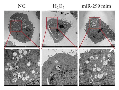 Mir 299 5p Reversed H2o2 Induced Apoptosis And Autophagy Of Np Cells By