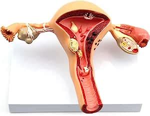 Amazon Teaching Model Human Female Uterus Pathology Model Body