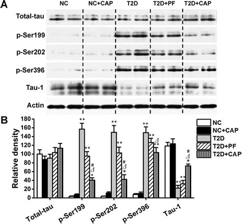 Western Blotting Analysis Of Phosphorylation Of Tau Protein In Rat