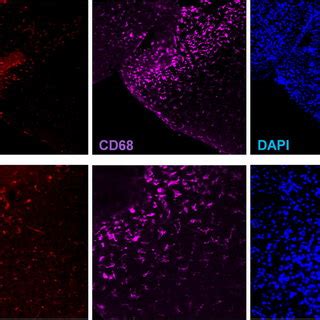 Co Immunofluorescence Of CD68 In The CAPS Of Cx3cr1GFP GFP Ccr2RFP RFP