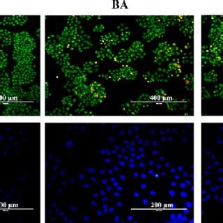 Morphological Evaluation Of Apoptosis In Siha Cells Treated With Ba And