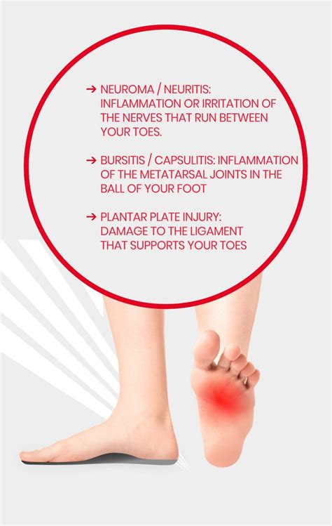 Relieve Ball of Foot Pain Fast: Get Expert Treatment with Prescription ...