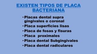 Placa Bacteriana Dental50 PPT