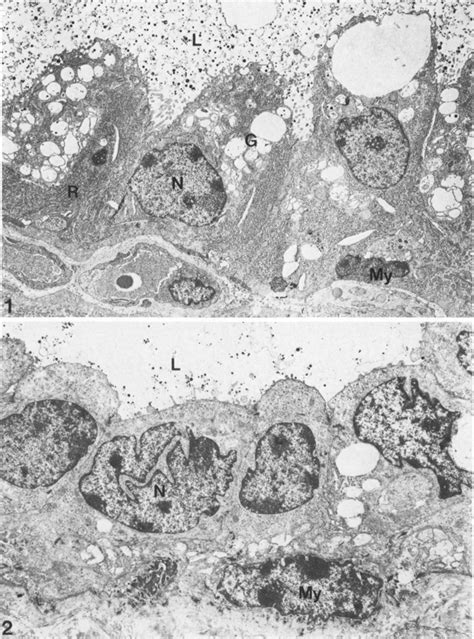 Mammary Epithelial Cells From Lactating And Non Lactating Glandular