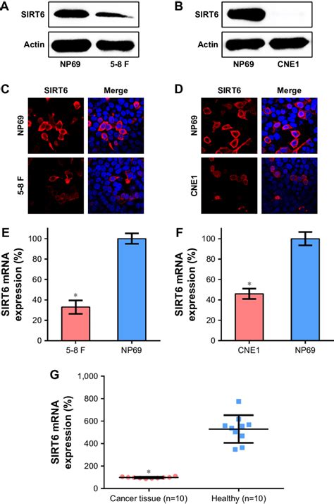 Expression Of Sirt In Npc Cells Or Tissue Specimens Notes A B