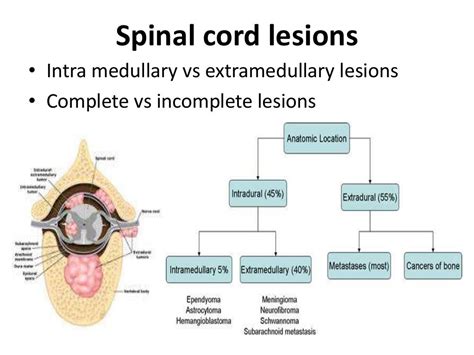 Spinal Cord Syndromes An Overveiw