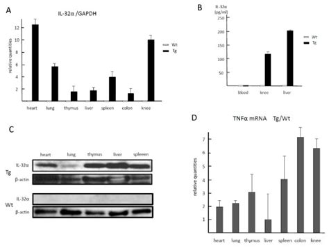 Overexpression of transgene derived interleukin 32 alpha IL 32α in