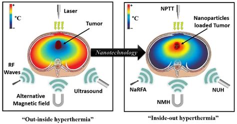 Jnt Free Full Text Recent Advances In Gold Nanomaterials For Photothermal Therapy