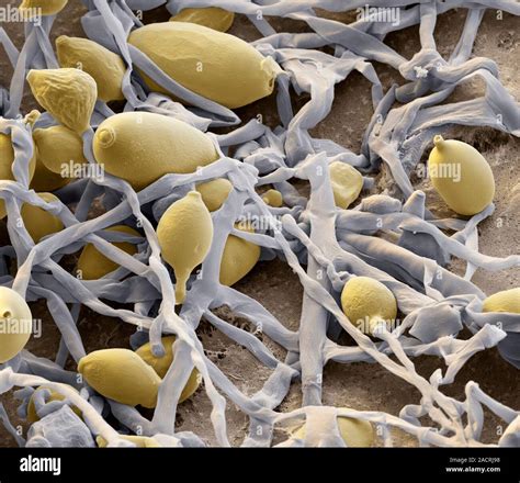 Blight Fungus Coloured Scanning Electron Micrograph Sem Of A