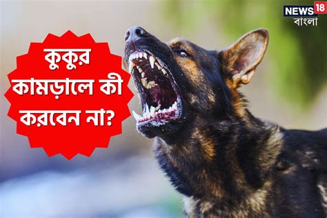 Dog Bite কুকুর কামড়ালে প্রথমেই কী করবেন না জানুন ভয় না পেয়ে এই