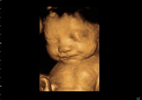 32 Weeks Baby In 3d 4d Scan Ultrasound 32 Weeks Baby Image Flickr