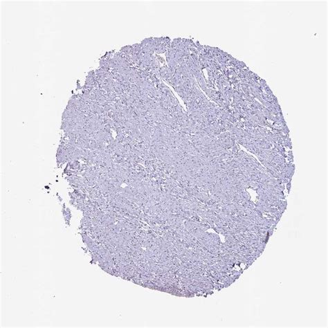 Tissue Expression Of Styk1 Staining In Cervix The Human Protein Atlas