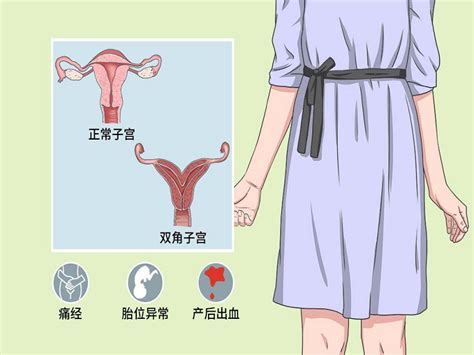 双角子宫早期症状与诊断标准 双角子宫治疗费用及方案 柚喜学园