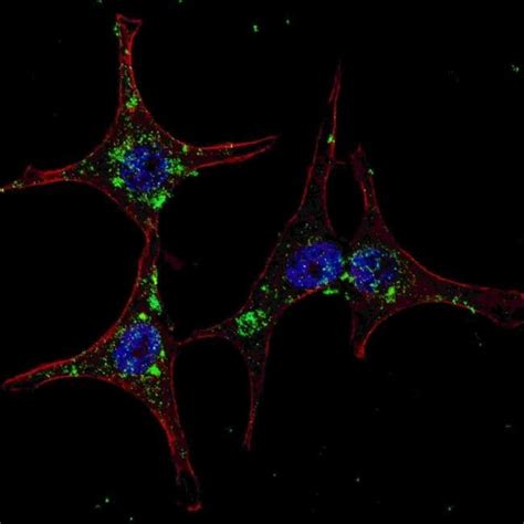 HRD1 Polyclonal Antibody Invitrogen 400 μL Unconjugated Fisher