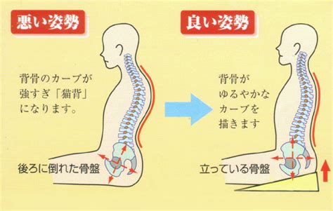 猫背を矯正し、肩こり・腰痛を解消しよう【はつらつライフ】