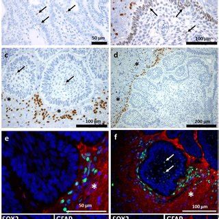 Immunohistochemical Expression Pattern Of Sox In Acp And Surrounding