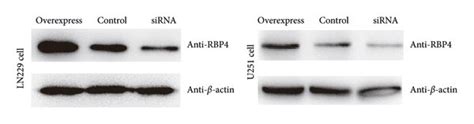 Rbp4 Promotes Gbm Proliferation Migration And Invasion A Ln229 And