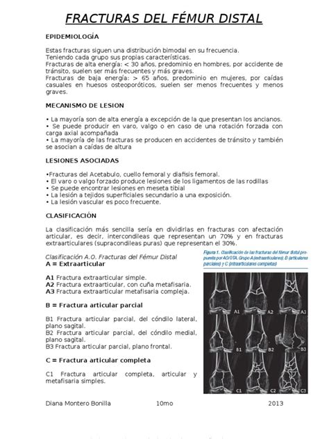 Fracturas Del FÉmur Distal Knee Medicine