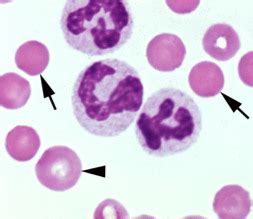 A P II Blood Lab Flashcards Quizlet