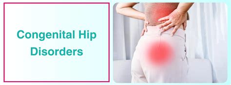 Congenital Hip Dislocation Causes Symptoms And Treatment