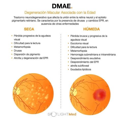 Pin De Cristhian Maria Jir N Aguirre En Oftalmo Optica Y Optometria