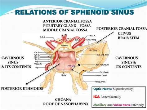 Sphenoid Sinus And Optic Nerve