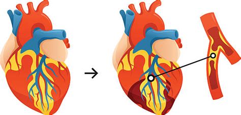 Heart Surgery Clipart