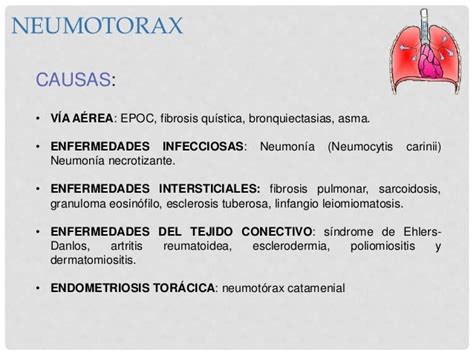 Neumotorax