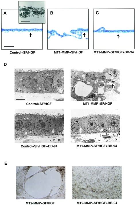 Invasion Of Peritoneal Tissue By MDCK Transfectants In Vivo A Vector