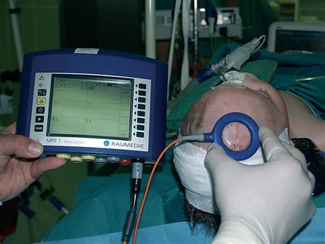 New Telemetric Intracranial Pressure Monitoring System Neurosurgery Blog