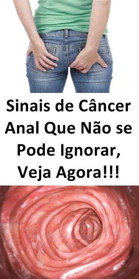 Câncer de Ânus Sintomas que a Maioria das Pessoas Ignoram canceranal