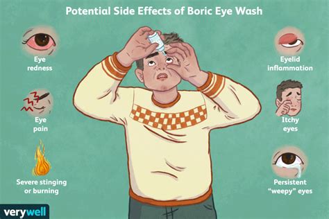 Boric Acid Eye Wash Uses Procedure And Side Effects