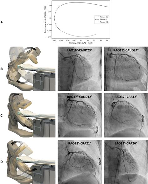 Combining Optimized Image Processing With Dual Axis Rotational