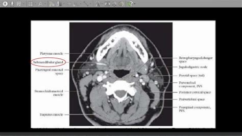 Ct Neck Anatomy - Anatomical Charts & Posters