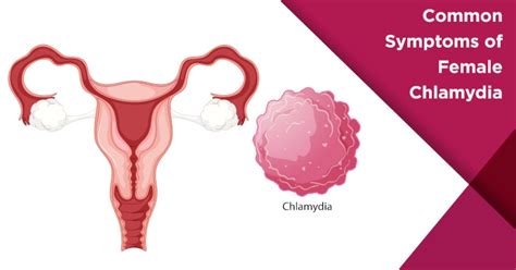 Chlamydia On Women