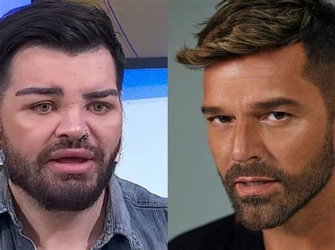 Argentino Faz Mais De Pl Sticas Para Se Parecer Ricky Martin