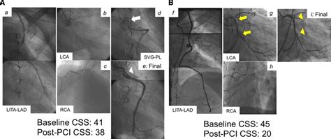 Validation Of The Coronary Artery Bypass Graft Syntax Score Synergy