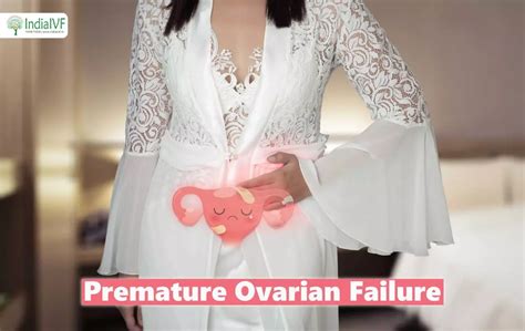 Premature Ovarian Failure Symptoms Causes And Treatment