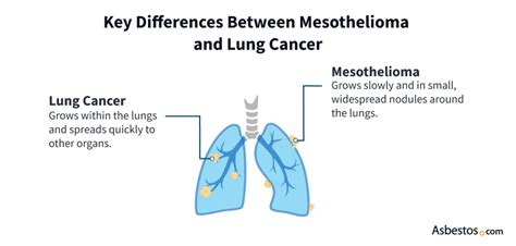 Mesothelioma Vs Lung Cancer My Resource Guide