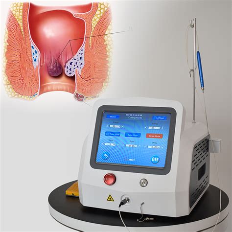 Best Laser Treatment Hemorrhoids Diode Medical Laser Surgery With 980