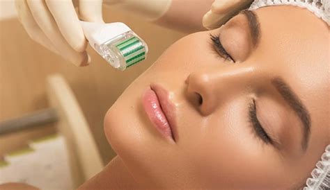 Why You Need Microneedling In Your Life