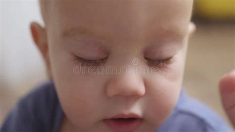 Close Up Baby Pink Eye Conjunctivitis On Caucasian Infant Child Face