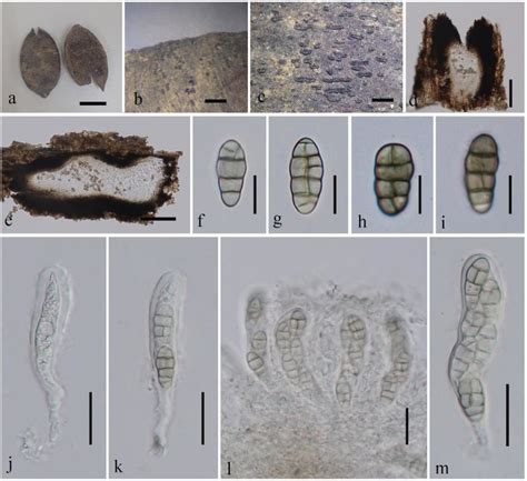 Gloniopsis Fluctiformis Mflu Holotype A Host Seeds B C