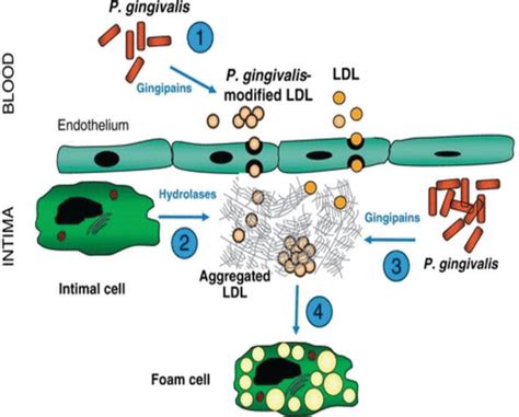 Cellular Response Mechanisms in Porphyromonas gingivalis Infection ... 