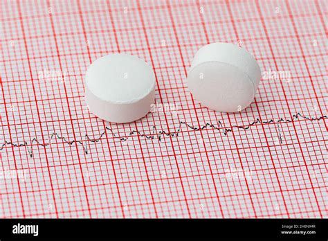 Aspirine sur bande EKG Crise cardiaque prévention des accidents