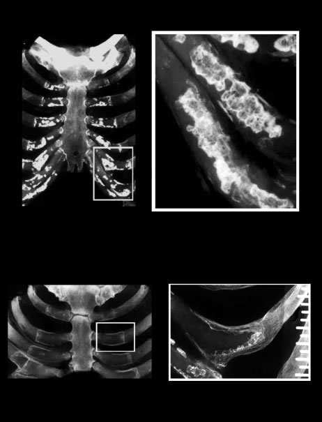 Sex Differences In The Ossification Of Costal Cartilage Download Scientific Diagram