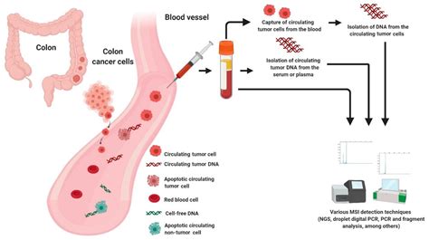 Diagnostics Free Full Text Microsatellite Instability In Colorectal