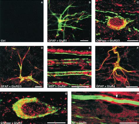 Immunohistochemical Localization Of AMPA Receptor Subunits In Dorsal