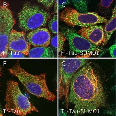 Sumo Tau Protein Subcellular Localization In Cells Morphology And