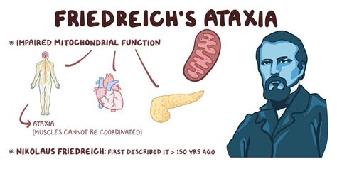 Friedreich S Ataxia What To Know